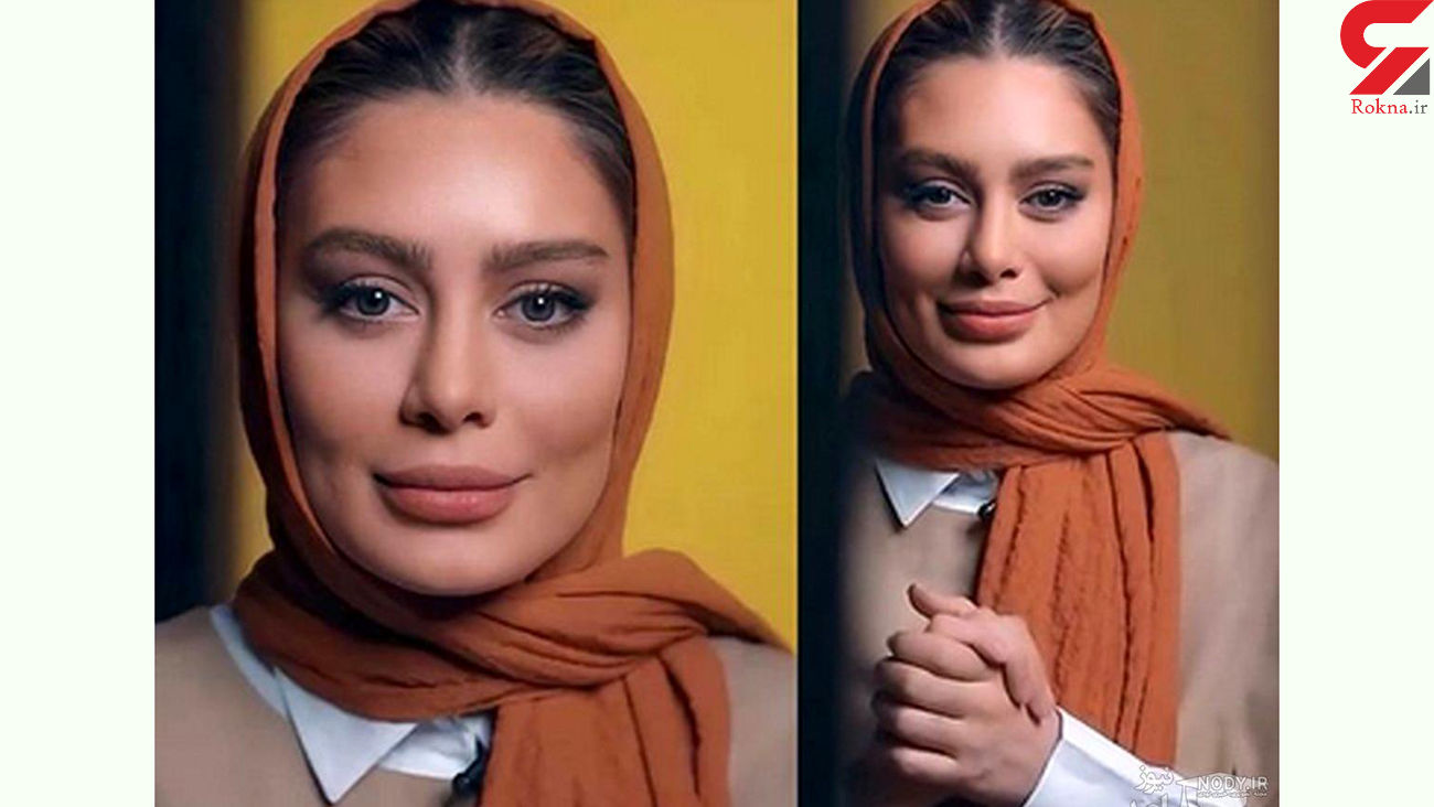 عکس بینی نافرم سحر قریشی قبل از عمل زیبایی سحر قریشی قبل عمل